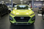 Hyundai Kona 1.0 T-GDI 115.043 km 11.980 &euro; Euskirchen 53881